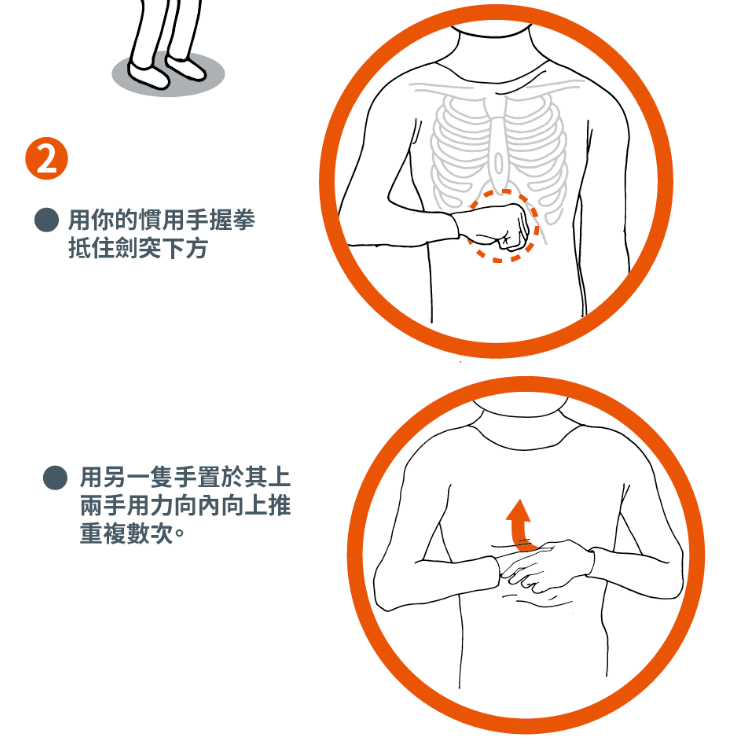 对自己施作哈姆立克法